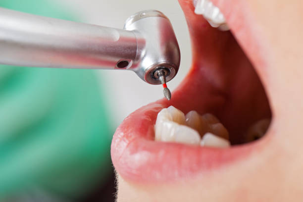 Best Emergency Dental Care for Sports Injuries in Vaeboro, NC